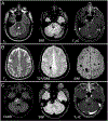 FIG. 2.