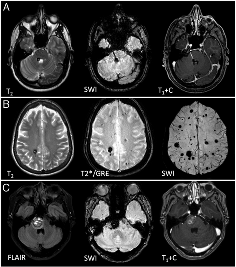 FIG. 2.