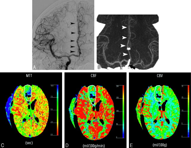 Fig 3.