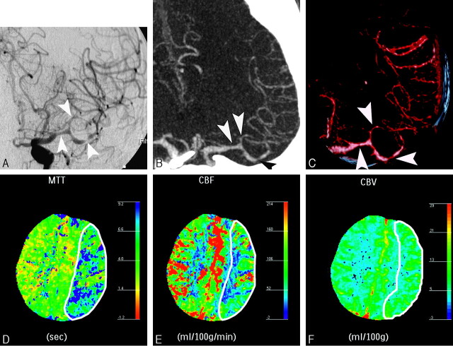 Fig 2.