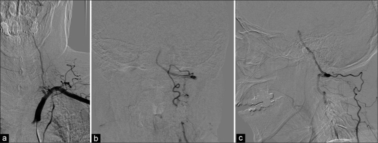 Figure 3: