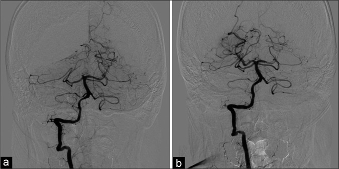 Figure 2: