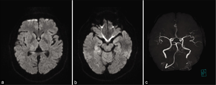 Figure 1: