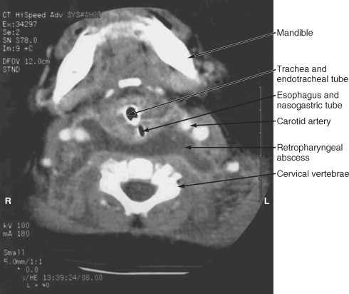 Figure 32-3