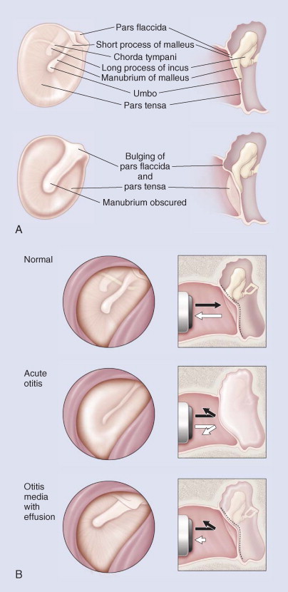 Figure 32-4