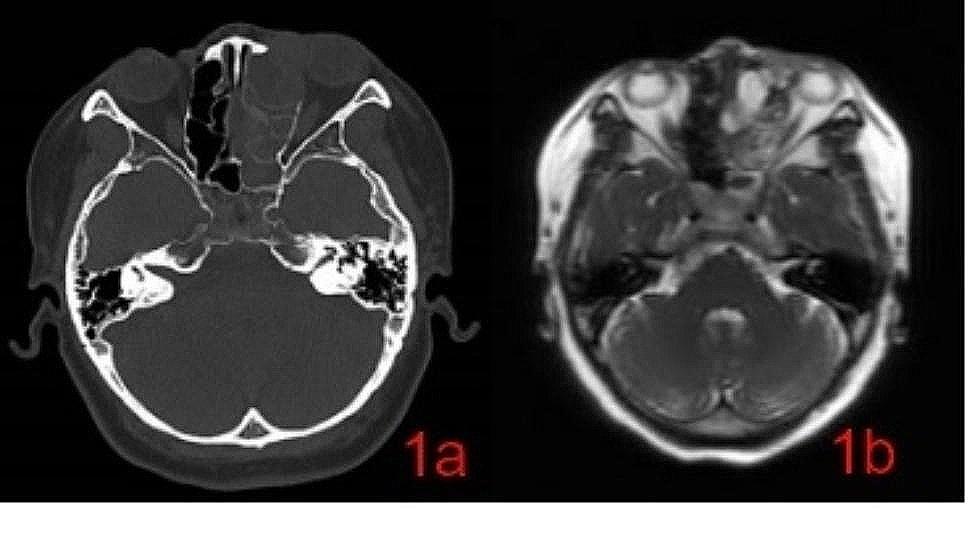 Fig. 1