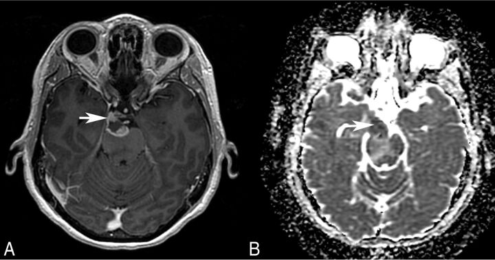 Fig 4.