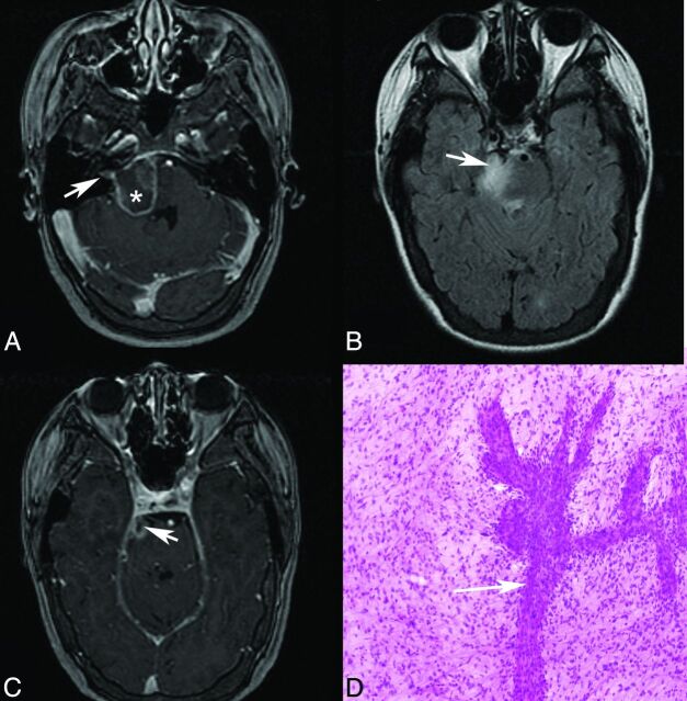 Fig 5.