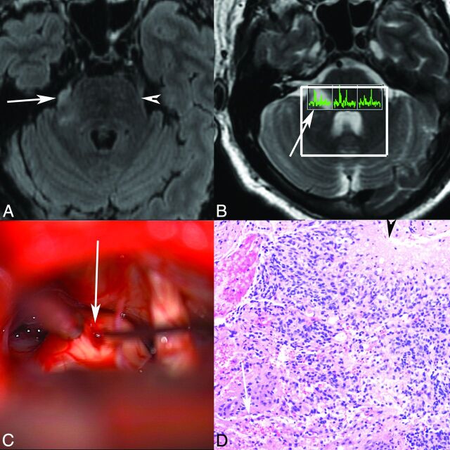 Fig 2.