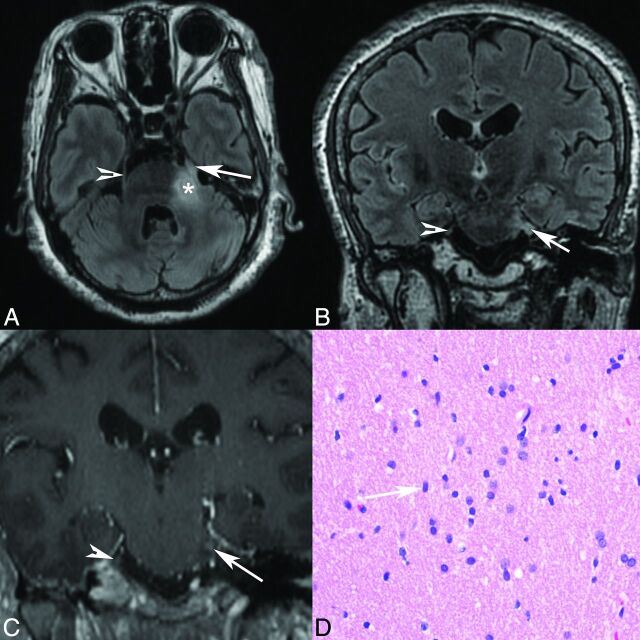 Fig 3.