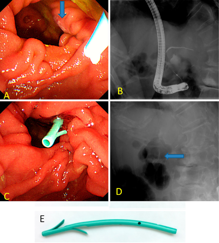 Figure 2.