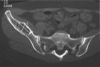 Figure 5A