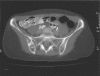 Figure 5B