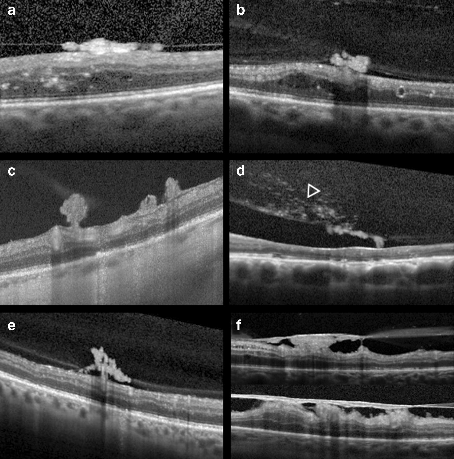 Fig. 4