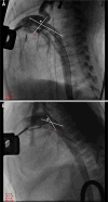 Fig. 5