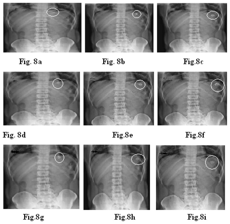 Fig. 8