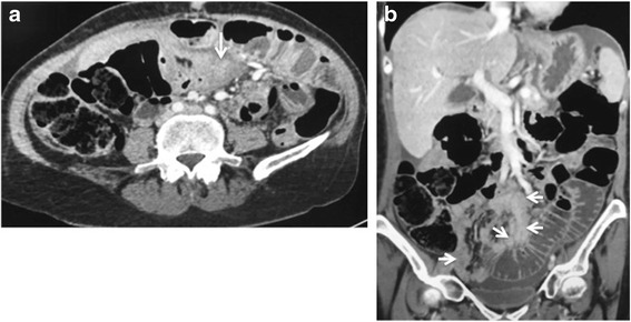 Fig. 10