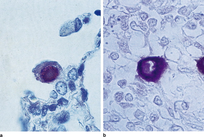 Fig. 26.3