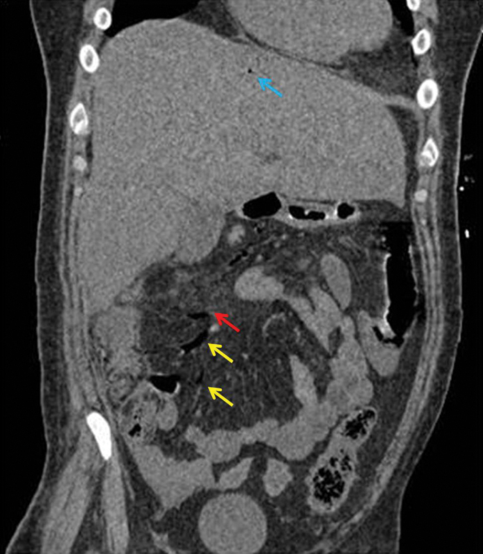 Fig. 3