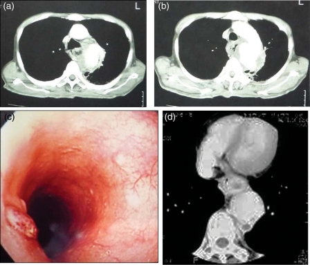 Figure 3: