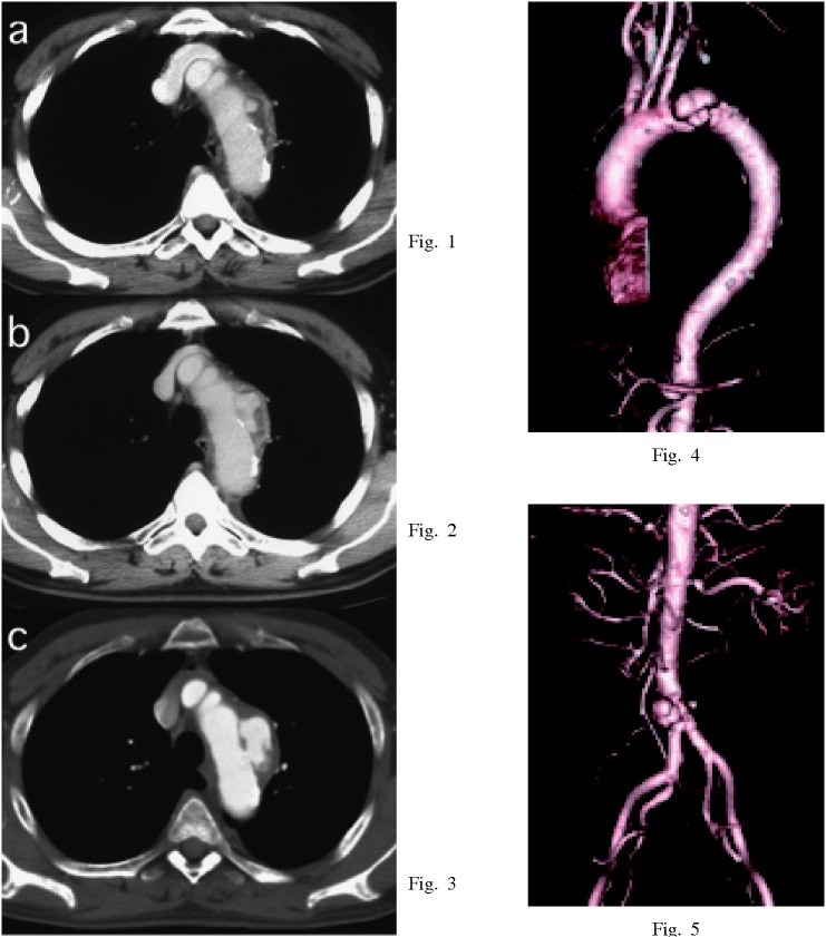 Fig. 1-5