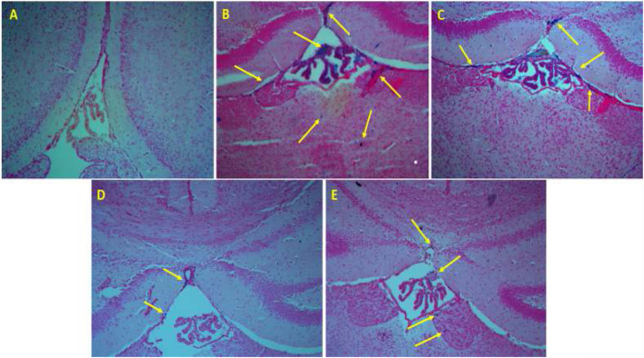 FIGURE 3