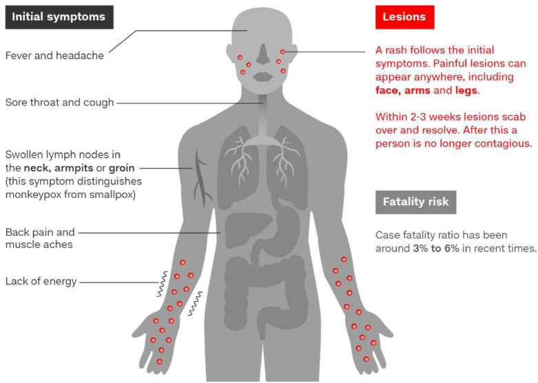 Fig-4