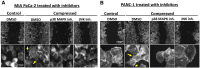 Figure 4. p38 MAPK/HSP27 and JNK/c-Jun signaling axes promote mechanical stress–induced actin cytoskeleton remodeling. Representative images of phalloidin staining in control and compressed MIA PaCa-2 (A) and PANC-1 (B) cells treated with DMSO, p38 MAPK or JNK inhibitors. In each panel, the first row shows representative images at the end of the wound healing assay, while the second row shows cells at the wound edge in higher magnification (scale bar: 1 and 0.1 mm, respectively). Yellow arrows indicate cell protrusions (lamellipodia, filopodia) that are necessary for cell migration.