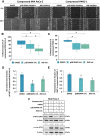 Figure 3. The p38 MAPK/HSP27 and JNK/c-Jun pathways are necessary for both proliferation and migration of pancreatic cancer cells under mechanical stress. A, MIA PaCa-2 and PANC-1 cells were pretreated with 15 μmol/L p38 MAPK inhibitor (SB202190), JNK inhibitor (SP600125) or equal volume of DMSO and subjected to a scratch wound healing assay under 4.0 mmHg of compression. Pictures from at least four different fields were taken from three biological replicates. Scale bar: 0.2 mm. White dashed line shows the difference in wound closure between 0 and 16 hours. Graph showing the average ±SE percentage wound closure of compressed MIA PaCa-2 (B) and PANC-1 (C) treated with DMSO or inhibitors from three biological replicates (n ≥ 12). Asterisk (*) indicates a statistically significant difference (P < 0.05 in one-way ANOVA analysis). Graph showing the average Ki67 area fraction in compressed MIA PaCa-2 (D) and PANC-1 (E) cells treated with DMSO, p38 MAPK or JNK inhibitor from at least 10 different fields/condition from two biological replicates as quantified automatically using an in-house code in MATLAB. Asterisk (*) indicates a statistically significant difference in Student t test (P < 0.05). F, Representative immunoblotting showing phosphorylated HSP27 (Ser 82) and c-Jun (S73) in control and compressed MIA PaCa-2 cells treated with 15 μmol/L of each inhibitor or equal volume of DMSO. Antibody against β-actin was used as a loading control. Quantification of each antibody compared with loading control was quantified by ImageJ and it is indicated by numbers in gray font.