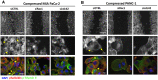 Figure 6. Rac-1 and cdc42 small GTPases mediate actin cytoskeleton remodeling and contractility to induce cell migration under stress. Representative images of phalloidin and phospho-myosin II (p-myosin II) staining in compressed MIA PaCa-2 (A) and PANC-1 (B) cells treated with siCTRL, siRac-1, or sicdc42. In each panel, the first row shows representative images at the end of the wound healing assay, while the second row shows cells at the wound edge in higher magnification (scale bar: 1 and 0.1 mm, respectively). Yellow arrows indicate cell protrusions that are necessary for cell migration. Third row shows p-myosin II and phalloidin staining in high magnification (scale bar: 0.1 mm).
