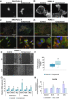 Figure 2. Mechanical stress induces cytoskeletal changes and cell contraction in pancreatic cancer cells promoting their migratory ability. Phalloidin staining was performed to monitor cell shape, actin cytoskeleton organization of control (0 mmHg) and compressed (4 mmHg) MIA PaCa-2 (A) and PANC-1 (B) cancer cells. Scale bar 0.1 mm. Staining for phospho-myosin II (Ser1943) was performed to show actomyosin contractility in control and compressed MIA PaCa-2 (C) and PANC-1 (D) cells. Scale bar 1 and 0.1 mm, respectively. E, PANC-1 cells were compressed by 4.0 mmHg in low-serum medium and then subjected to a scratch wound healing assay for 16 hours. Control cells (0 mmHg) were compressed by an agarose cushion only. Scale bar: 0.2 mm. F, Graph showing the average percentage of wound closure ±SE as quantified using ImageJ software. Statistically significant difference in wound closure of compressed PANC-1 cells compared with control cells is indicated with an asterisk (*) (n ≥ 10; three biological replicates; P < 0.05 in Student t test). G, Relative mRNA expression of EMT markers Snail, Twist, Slug as quantified by qPCR in MIA PaCa-2 and PANC-1 cells. Each bar indicates the mean fold change ±SE of three independent experiments (n = 9). Asterisk (*) indicates a statistically significant difference (P < 0.05 in Student t test). H, G-LISA was performed to analyze activation of cdc42 and Rac-1 small GTPases in compressed (4.0 mmHg) cells at different timepoints. Assay was performed in triplicates and graphs represent the average fold change ±SE of each protein in compressed relative to uncompressed (control) cells. Asterisk (*) indicates a statistically significant difference (P < 0.05 in Student t test).