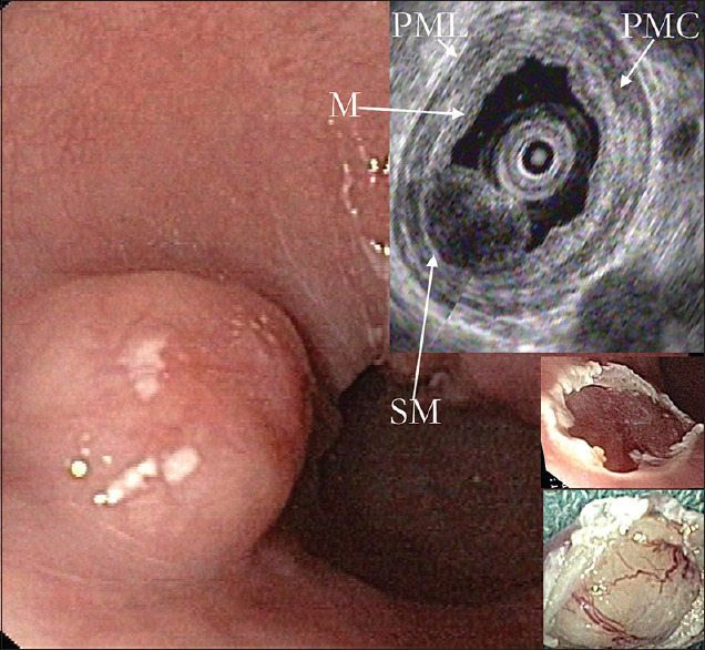 Figure 14