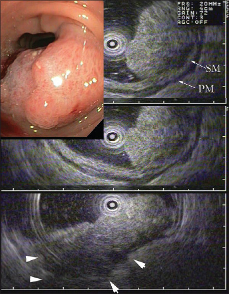 Figure 10