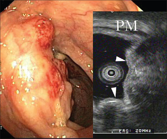 Figure 19