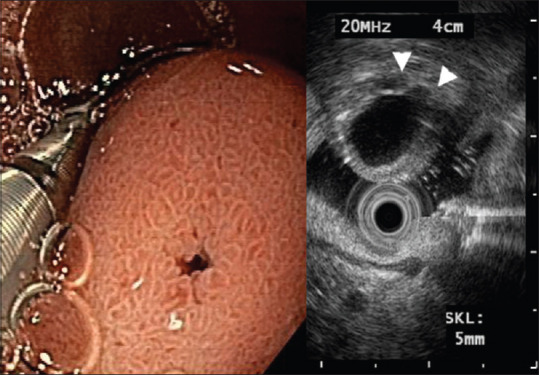 Figure 21