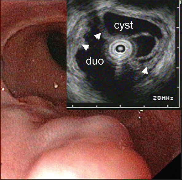 Figure 22