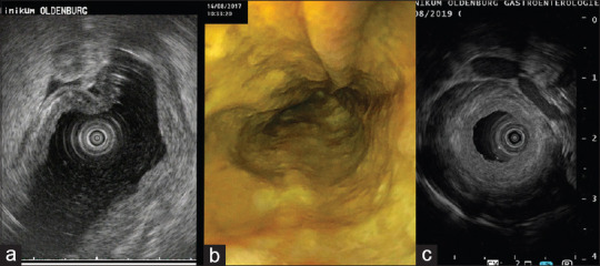 Figure 27