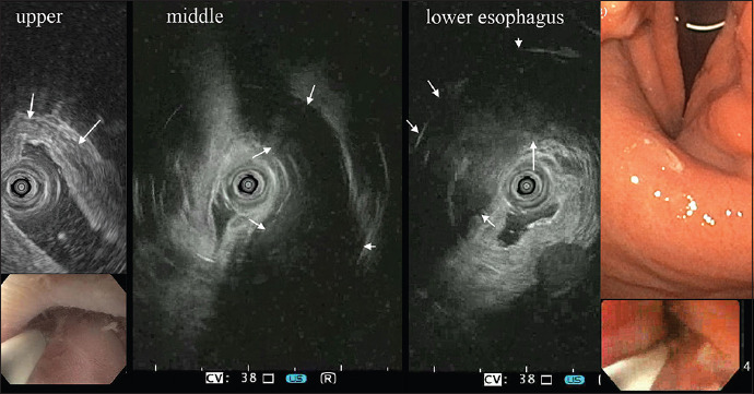 Figure 26