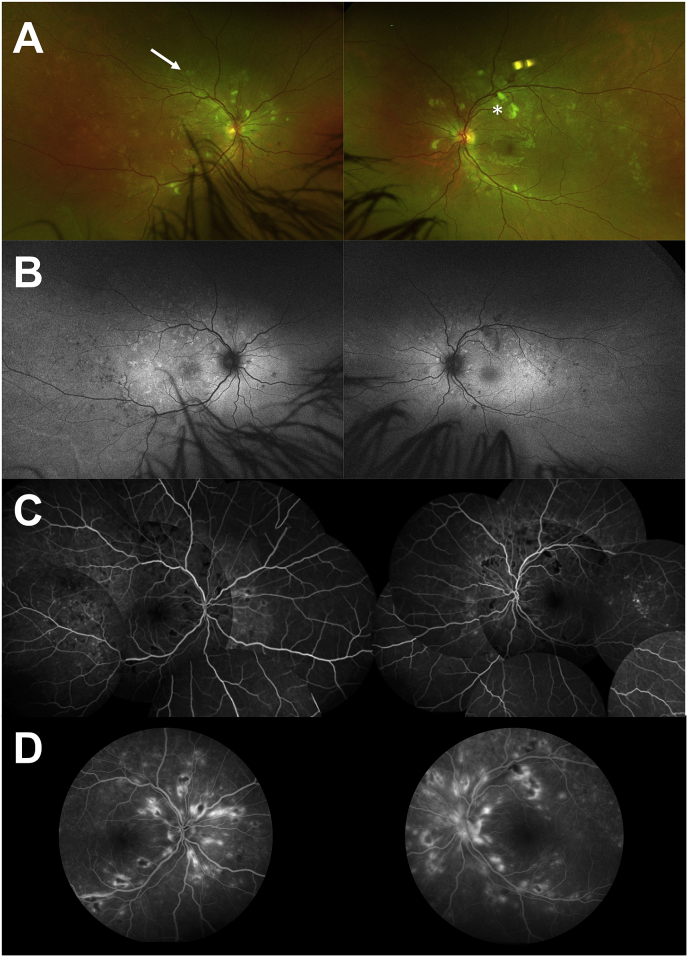 Fig. 1