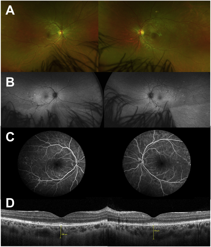 Fig. 4