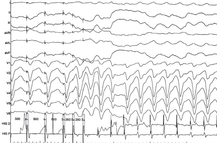 Figure 2: