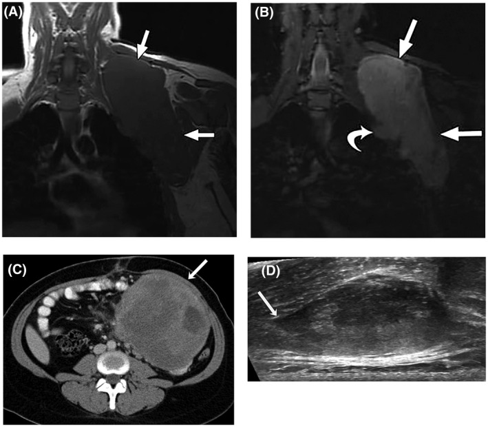 FIGURE 1