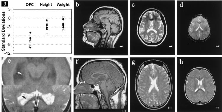 Figure  2