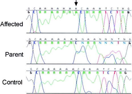 Figure  4