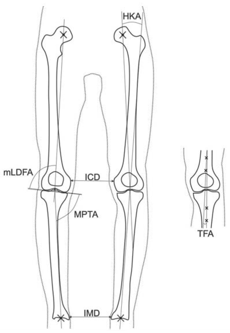 Bowlegs and Intensive Football Training in Children and Adolescents: A ...