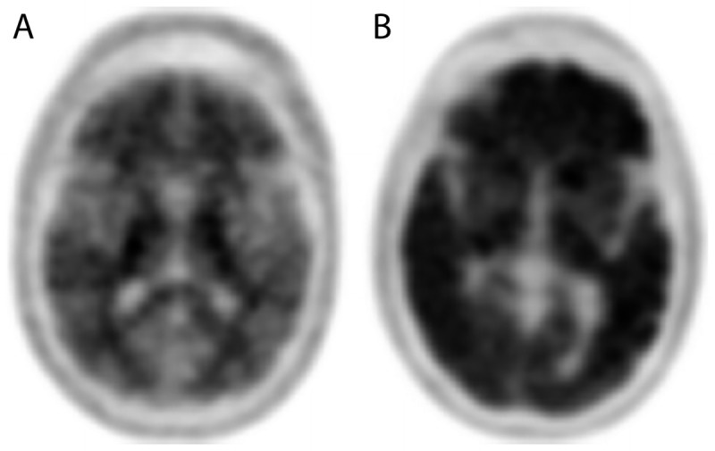 Figure 3-4