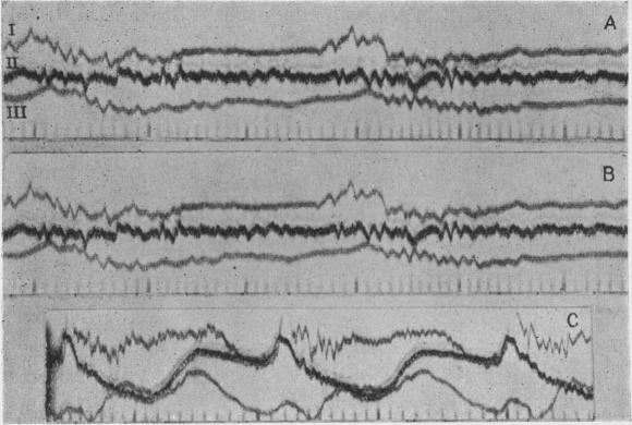 Fig. 19