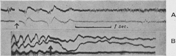 Fig. 20