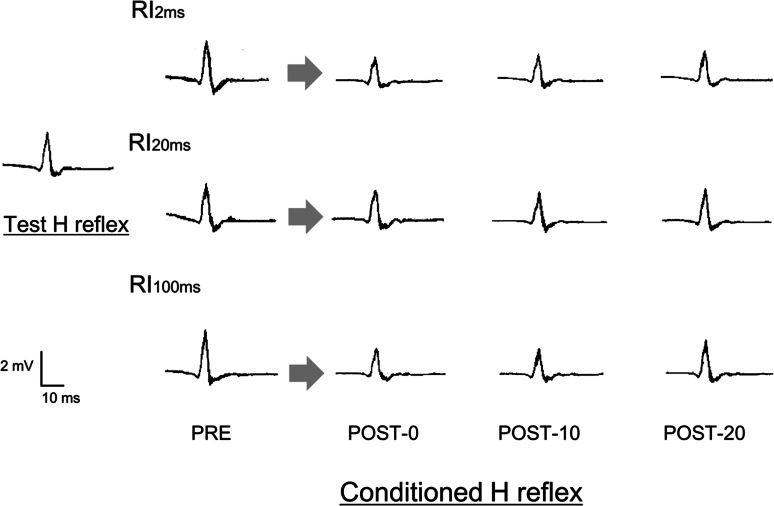 Fig. 2