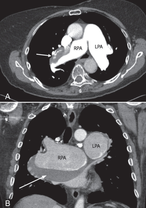 Figure 1)